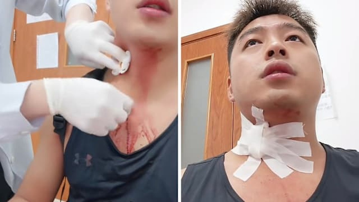 Cuộc Sống Đứng Trước Nguy Cơ Vì Cú Đập Muỗi: Một Câu Chuyện Đáng Suy Ngẫm